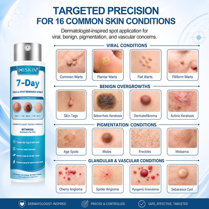 💎💎💎𝐇𝐈𝐒𝐊𝐈𝐍®👩‍⚕️ 𝟕-𝐃𝒂𝘆 𝐒𝗸𝐢𝐧 𝐓𝒂𝗴 & 𝐒𝐩𝙤𝐭 𝐑𝒆𝐦𝙤𝘃𝒂𝐥 𝐒𝐩𝐫𝒂𝘆 Painless & Scar-Free Advanced Imper💎